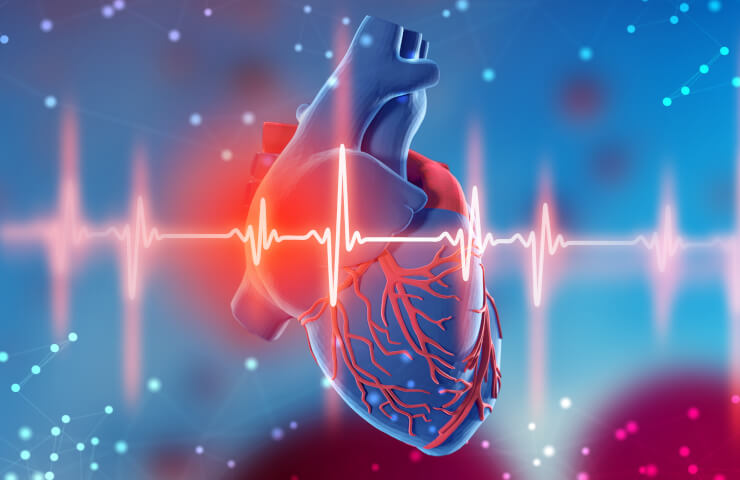Диагностика и лечение инфаркта Миокарда