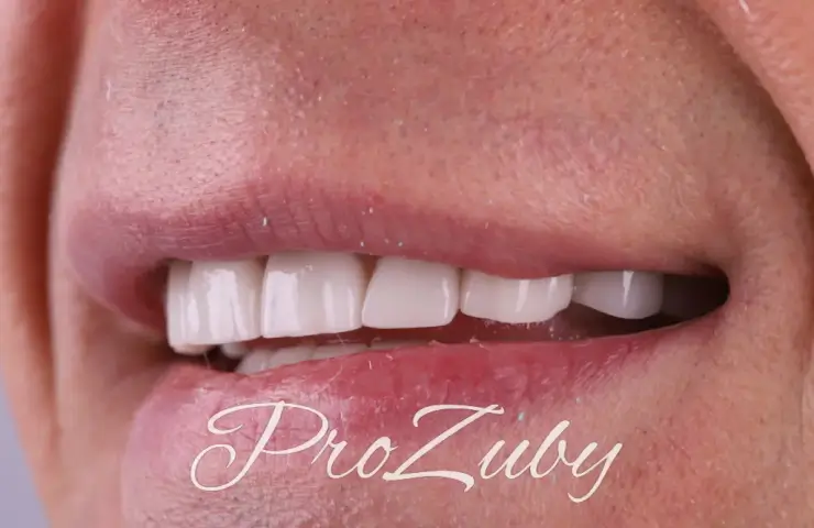 Инновационные методики протезирования зубов